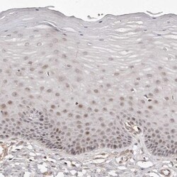 SOX4 Antibody, Novus Biologicals:Antibodies:Primary Antibodies